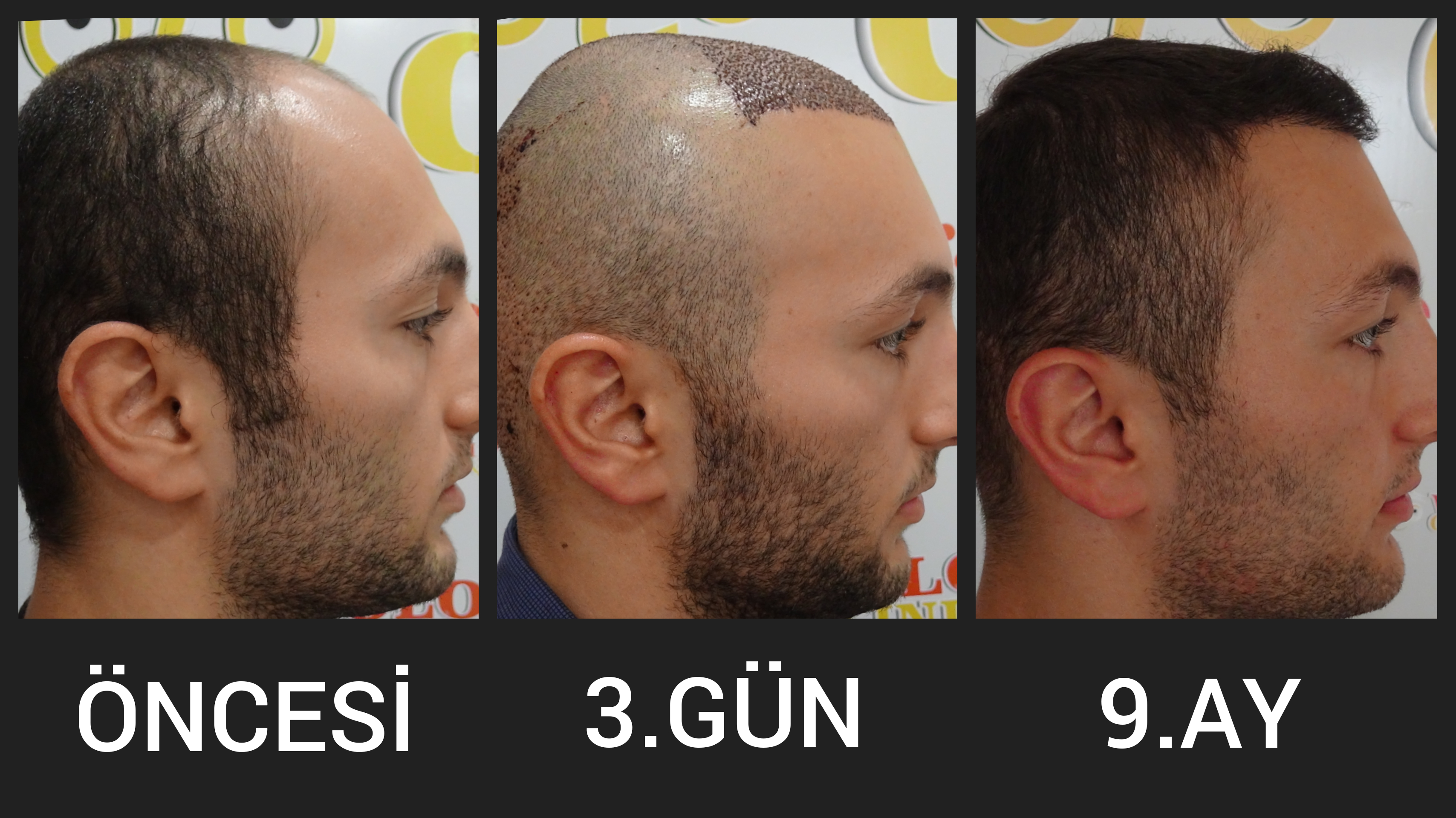 Ergebnis 3